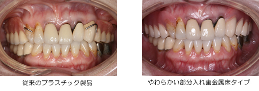 従来の比較