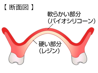 断面図